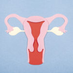 irregular periods, irregular menstrual cycles affects women OF reproductive age, fertility problems, negative body image developing pcos