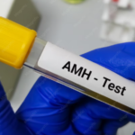 AMH Test