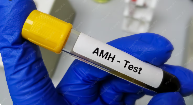 AMH Test