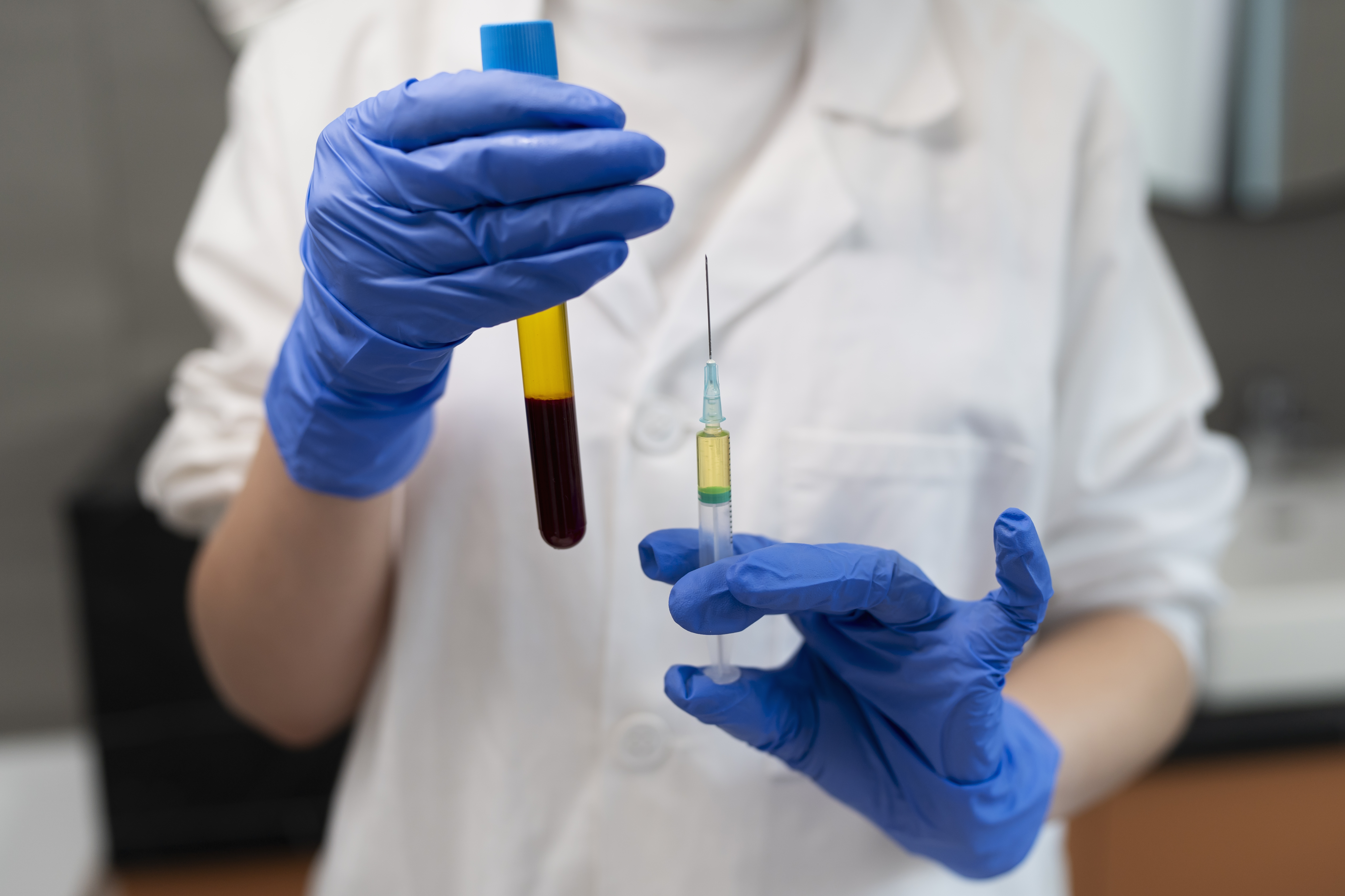 PRP