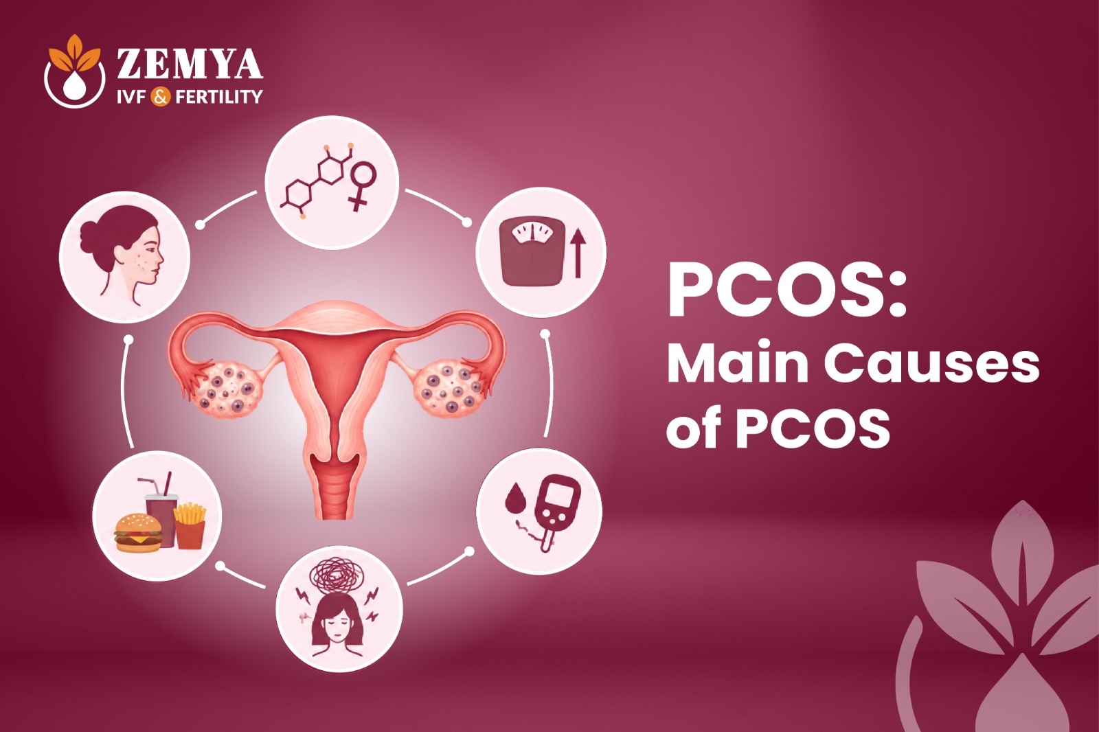 pcos