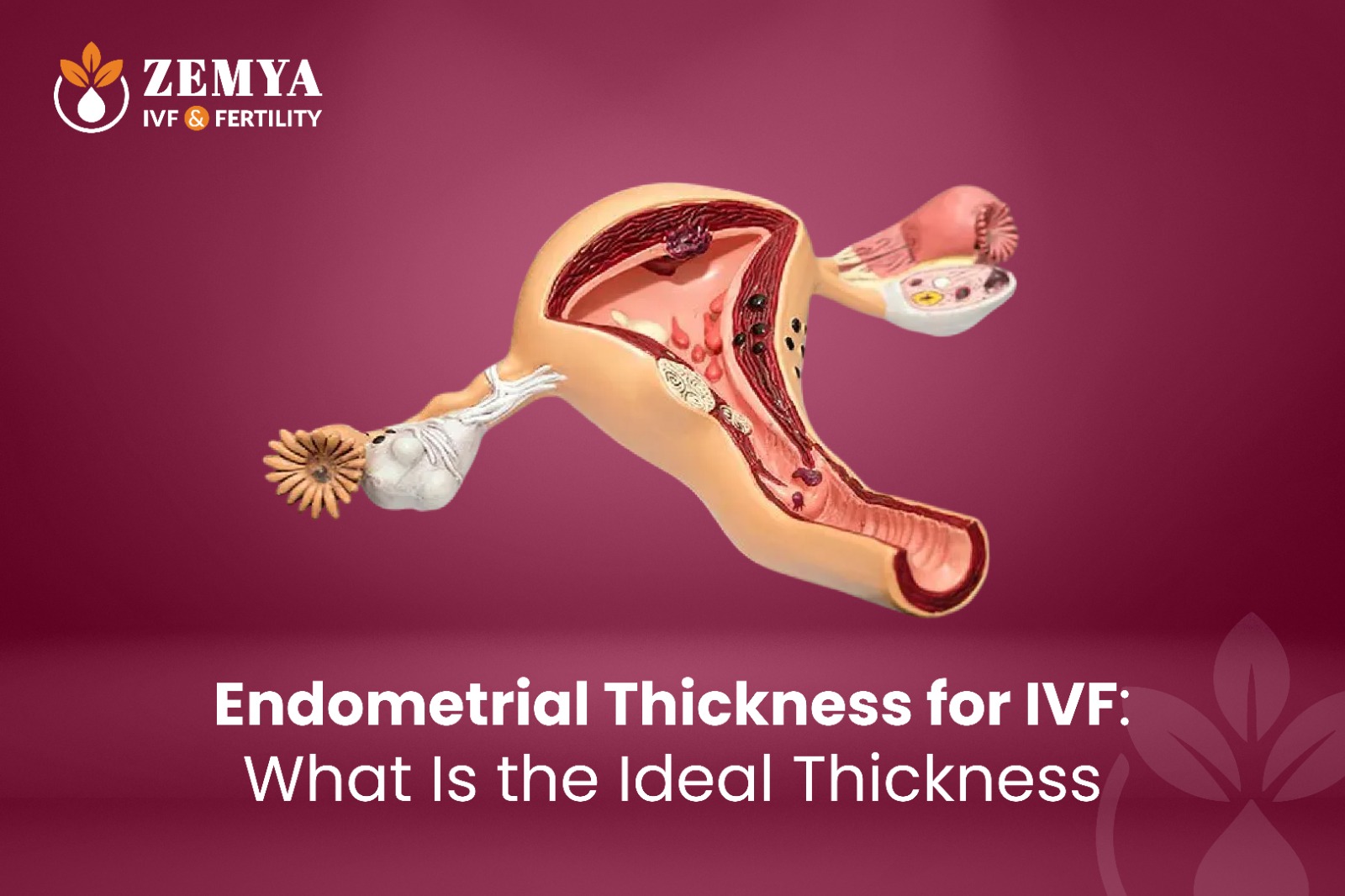 Endometrial Thickness