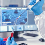 HSG, also known as hysterosalpingography, is a method that helps doctors see the shape of the inside of your uterus and your fallopian tubes.